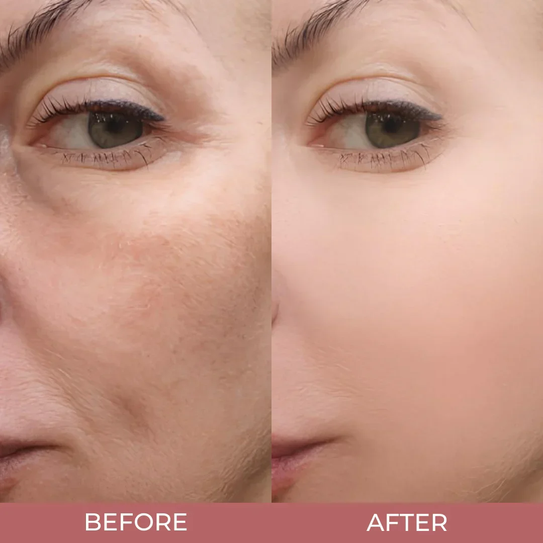 Peel Shot Glow Rice Ampoule Duo by Eryos